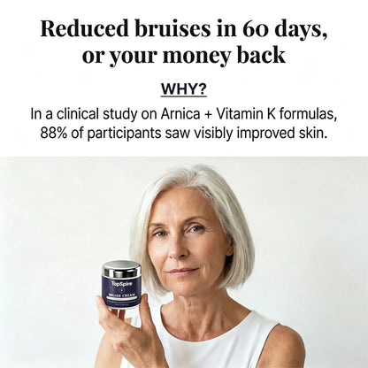 💥75K+ SOLD💕-  TopSpire® Bruise Repair & Skin-Strengthening Cream
