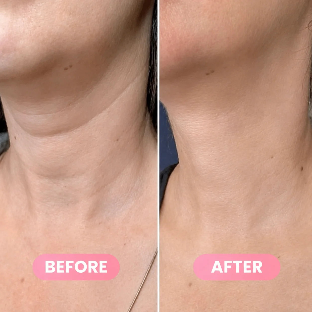 Silvelyo™ PDRN Collagen Gua Sha Neck & Contour Cream