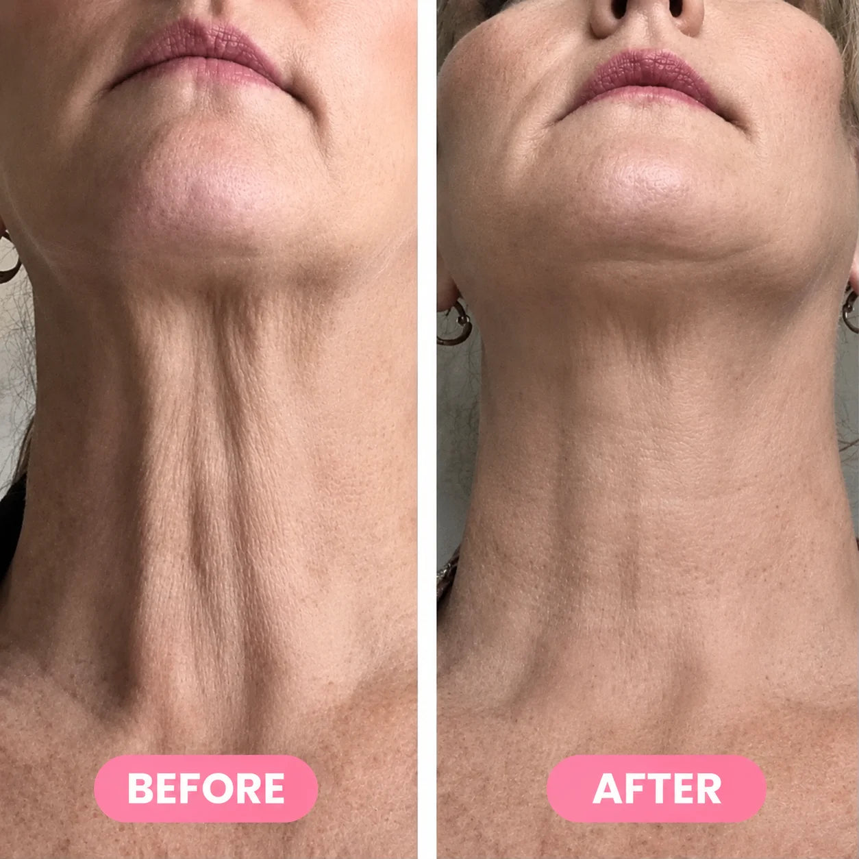 Silvelyo™ PDRN Collagen Gua Sha Neck & Contour Cream