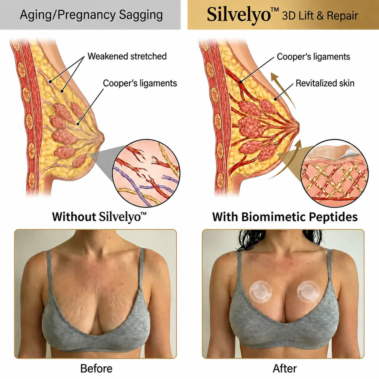 🔥Limited-time 60% sale--Silvelyo™ Targeted Breast Enhancement Advanced Nano-Microneedle Patches
