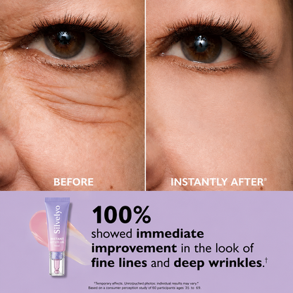 Silvelyo Eye Bag Instant Eraser, Tightens, Firms, & Blurs Wrinkles