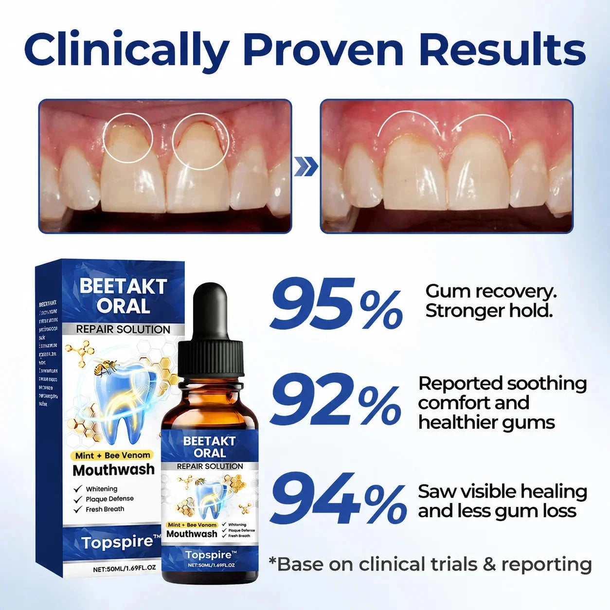 Topspire™ BeeTakt Oral Repair Solution