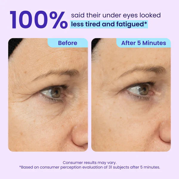 Silvelyo Eye Bag Instant Eraser, Tightens, Firms, & Blurs Wrinkles