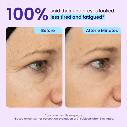 Silvelyo Eye Bag Instant Eraser, Tightens, Firms, & Blurs Wrinkles