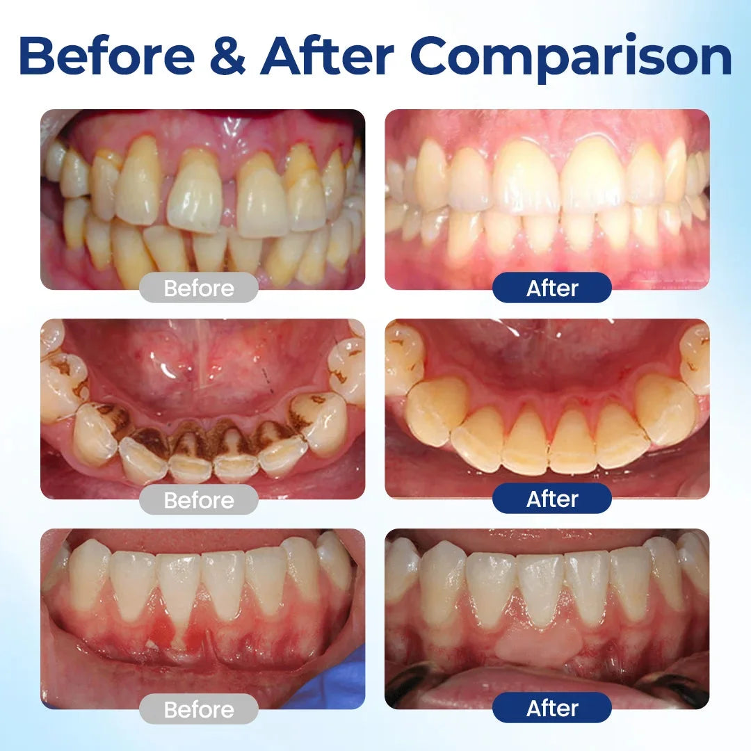 Topspire™ BeeTakt Oral Repair Solution