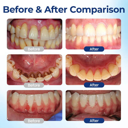 Topspire™ BeeTakt Oral Repair Solution