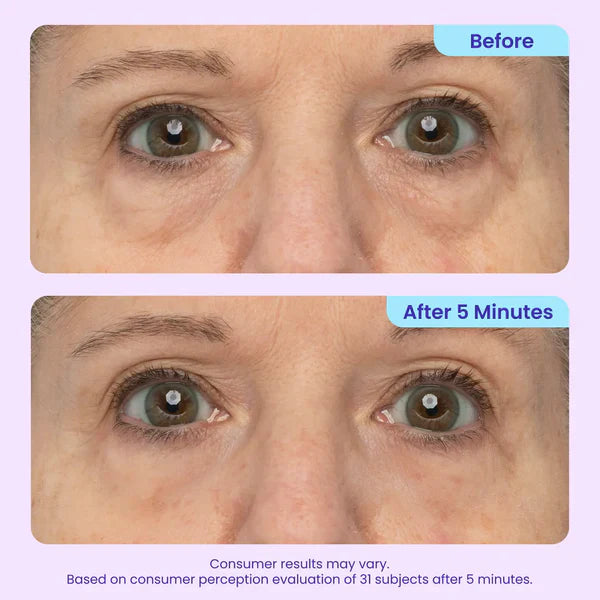 Silvelyo Eye Bag Instant Eraser, Tightens, Firms, & Blurs Wrinkles