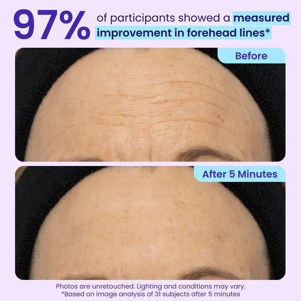 Silvelyo Eye Bag Instant Eraser, Tightens, Firms, & Blurs Wrinkles