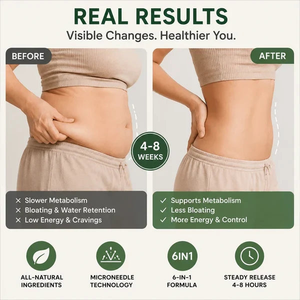 Silvelyo™ Advanced Mikronadel-Wellness-Pflaster