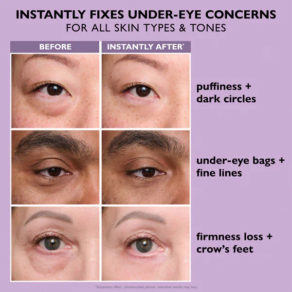 Silvelyo Eye Bag Instant Eraser, Tightens, Firms, & Blurs Wrinkles