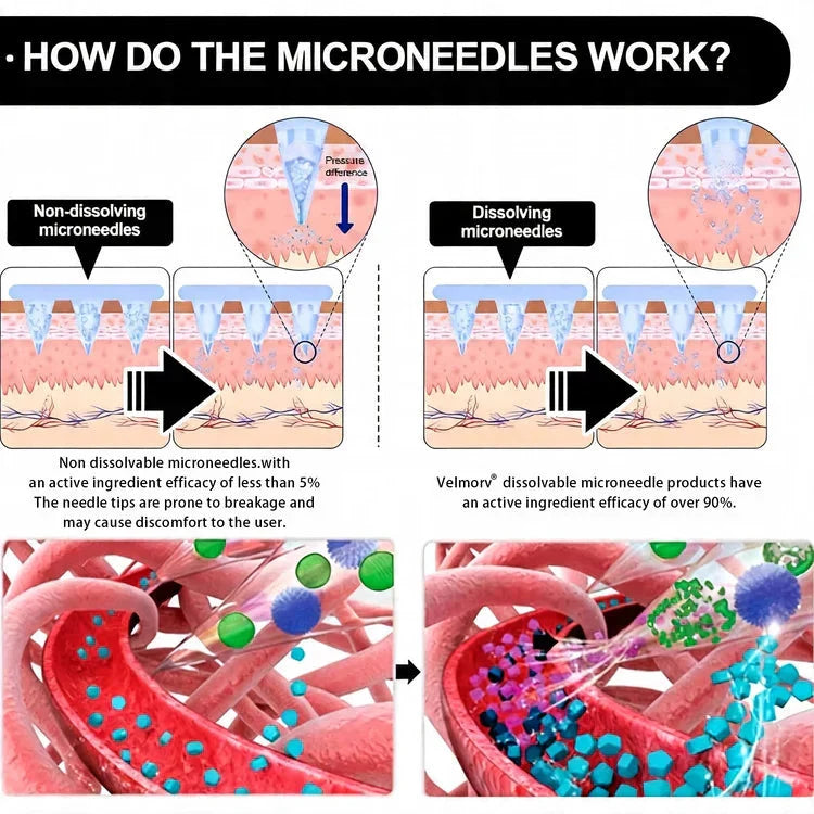 Silvelyo™ Advanced Microneedle Wellness Patch