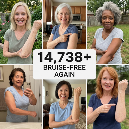 💥75K+ SOLD💕-  TopSpire® Bruise Repair & Skin-Strengthening Cream